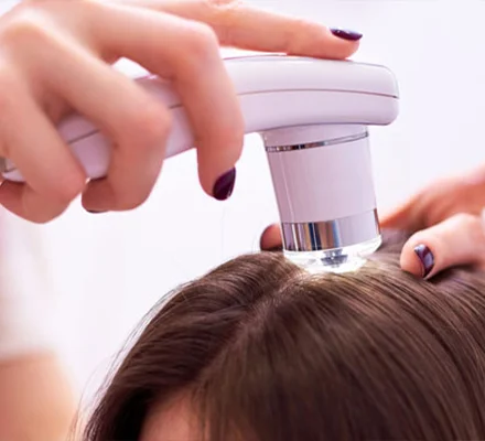 Trichologie, diagnostika vlasů